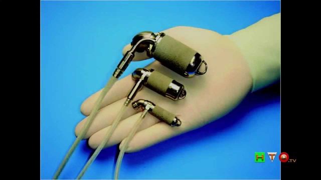 Ospedale Pediatrico Bambino Gesù – Parte sperimentazione cuore artificiale pediatrico – www.HTO.tv